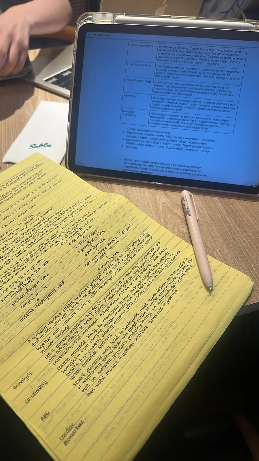 Working on my SGD output using my tablet and handwritten notes.